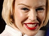 Kylie Minogue botox nesluí